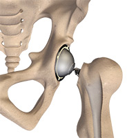 Hip Image Hip