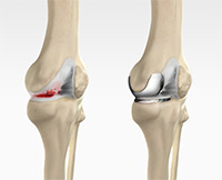 Knee Image Knee