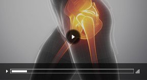 Patient Education Video