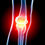 Anterior Knee Pain