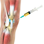 Knee PRP